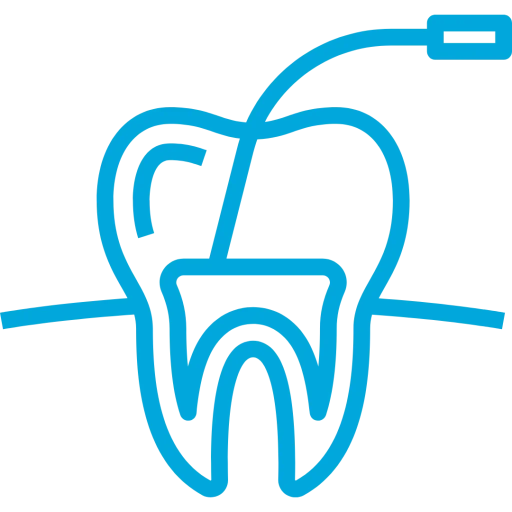 devitalizzazione dente a Magenta e Segrate